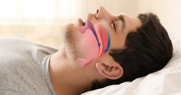 Bật mí mẹo chữa há miệng khi ngủ